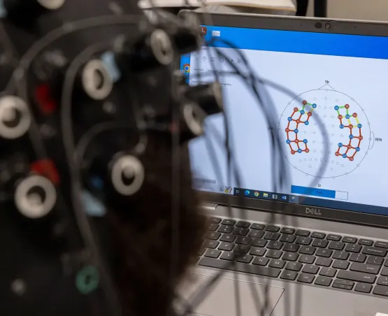 A laptop shows data received from the fNIRS cap; green and blue indicate good signal, while red indicates poor signal.